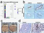 Cytokeratin 8 Antibody in Immunohistochemistry (PFA fixed) (IHC (PFA))