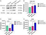 Plasminogen Antibody in Western Blot (WB)