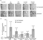 Progesterone Receptor Antibody in Immunohistochemistry (IHC)