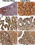 Progesterone Receptor Antibody in Immunohistochemistry (Paraffin) (IHC (P))