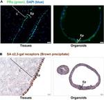 Progesterone Receptor Antibody in Immunohistochemistry (Paraffin) (IHC (P))