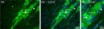 Progesterone Receptor Antibody in Immunocytochemistry (ICC/IF)
