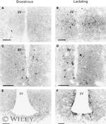 Prolactin Receptor Antibody in Immunohistochemistry (IHC)