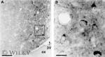 Prolactin Receptor Antibody in Immunohistochemistry (IHC)