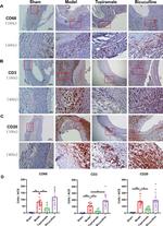 CD20 Antibody in Immunohistochemistry (Paraffin) (IHC (P))
