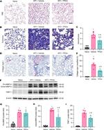 TIMP1 Antibody in Western Blot (WB)