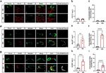 Calprotectin Antibody in Immunocytochemistry (ICC/IF)