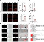 CCR2 Antibody in Immunocytochemistry (ICC/IF)