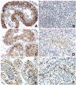 Galectin 3 Antibody in Immunohistochemistry (Paraffin) (IHC (P))