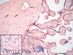 Endothelin 1 Antibody in Immunohistochemistry (IHC)