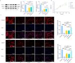 Aggrecan Antibody in Western Blot (WB)