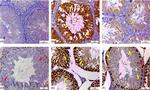 PCNA Antibody in Immunohistochemistry (IHC)