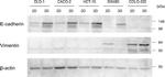 Vimentin Antibody in Western Blot (WB)
