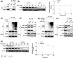 SNAIL Antibody in Western Blot, Immunoprecipitation (WB, IP)