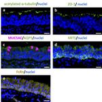 MUC5AC Antibody in Immunohistochemistry (IHC)
