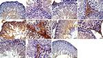 p53 Antibody in Immunohistochemistry (Paraffin) (IHC (P))