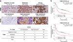 TGM2 Antibody in Immunohistochemistry (Paraffin) (IHC (P))
