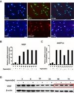 VEGF Antibody in Western Blot (WB)