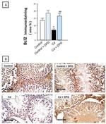 Bcl-2 Antibody in Immunohistochemistry (IHC)