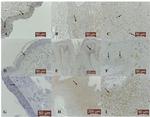 MMP13 Antibody in Immunohistochemistry (Paraffin) (IHC (P))