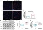 COX2 Antibody in Western Blot (WB)