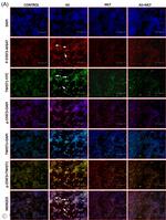 TWIST1 Antibody in Immunohistochemistry (IHC)