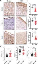 Fibulin 2 Antibody in Immunohistochemistry (IHC)
