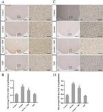 ASK1 Antibody in Immunohistochemistry (Paraffin) (IHC (P))