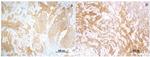 Tensin 4 Antibody in Immunohistochemistry (Paraffin) (IHC (P))