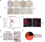 EGFR Antibody in Immunohistochemistry (Paraffin) (IHC (P))