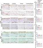 p16INK4a Antibody in Immunohistochemistry (IHC)