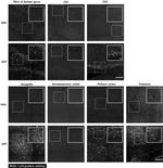 p16INK4a Antibody in Immunohistochemistry (Frozen) (IHC (F))