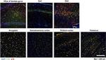 p16INK4a Antibody in Immunohistochemistry (Frozen) (IHC (F))