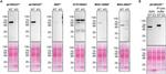 PPP2R5D Antibody in Western Blot (WB)