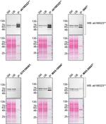 PPP2R5D Antibody in Western Blot (WB)
