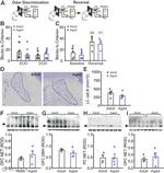 Norepinephrine Transporter Antibody in Western Blot (WB)