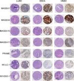 CT83 Antibody in Immunohistochemistry (IHC)