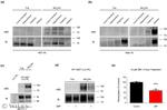 Dopamine Transporter Antibody in Western Blot (WB)