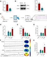 MCL-1 Antibody in Western Blot (WB)