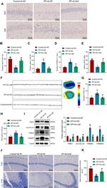 MCL-1 Antibody in Immunohistochemistry (Paraffin) (IHC (P))