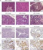 Cytokeratin 19 Antibody in Immunohistochemistry (Paraffin) (IHC (P))