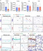 ACE2 Antibody in Immunohistochemistry (Paraffin) (IHC (P))