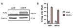 ACE2 Antibody in Western Blot (WB)