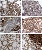 ETS1 Antibody in Immunohistochemistry (Paraffin) (IHC (P))