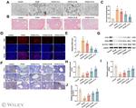 Ferritin Heavy Chain Antibody in Immunohistochemistry (IHC)