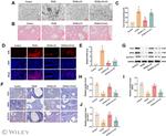 Ferritin Heavy Chain Antibody in Immunohistochemistry (IHC)