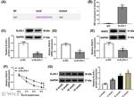 SOAT2 Antibody in Western Blot (WB)