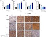 Ferritin Heavy Chain Antibody in Immunohistochemistry (Paraffin) (IHC (P))