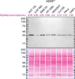 CK1 alpha Antibody in Western Blot (WB)