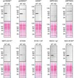 CK1 alpha Antibody in Western Blot (WB)